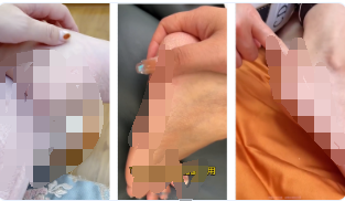 請勿使用皮膚干裂起皮、起屑、輕微干裂傷口等影響用戶體驗的素材設(shè)計，如【視頻中展現(xiàn)干裂起皮、起屑場景】，請修改