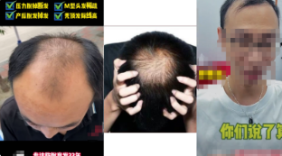駁回原因示例： 請勿出現(xiàn)丑陋的影響用戶體驗的元素，需重新設(shè)計廣告，如【視頻中展現(xiàn)禿頂、脫發(fā)脫毛形象】，請修改