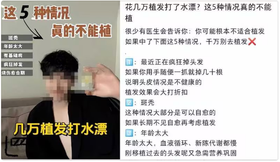 小紅書植發項目廣告