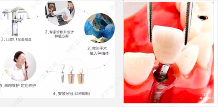 在知乎廣告投放時不能涉及具體的診療過程