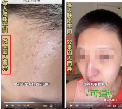 小紅書廣告標明“使用效果因人而異”